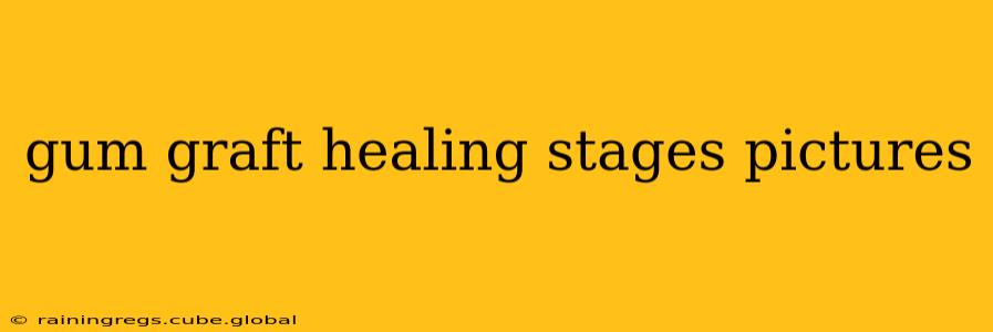 gum graft healing stages pictures