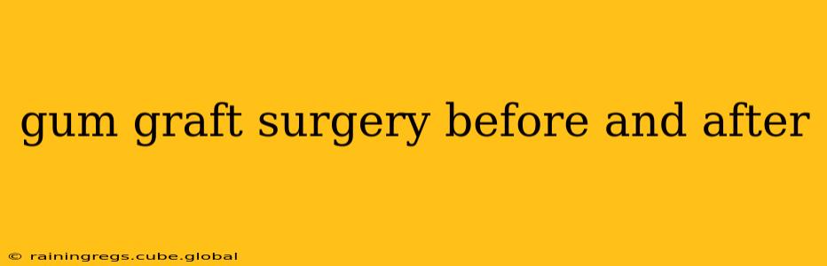 gum graft surgery before and after