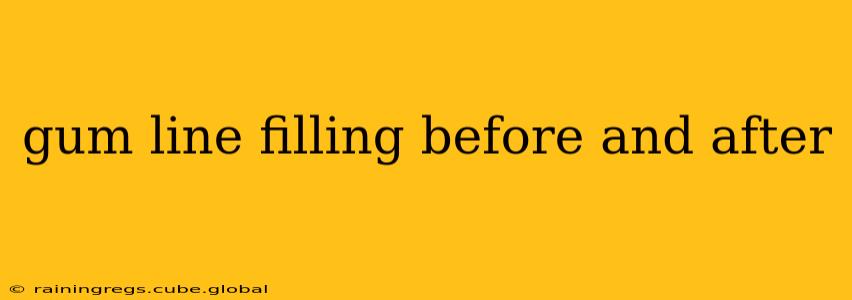 gum line filling before and after