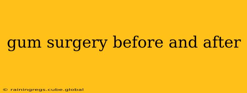 gum surgery before and after