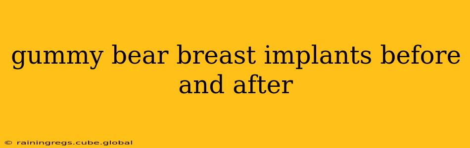 gummy bear breast implants before and after