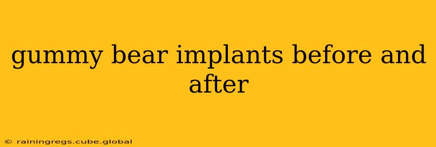 gummy bear implants before and after