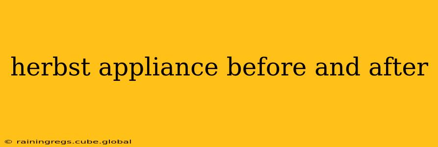 herbst appliance before and after