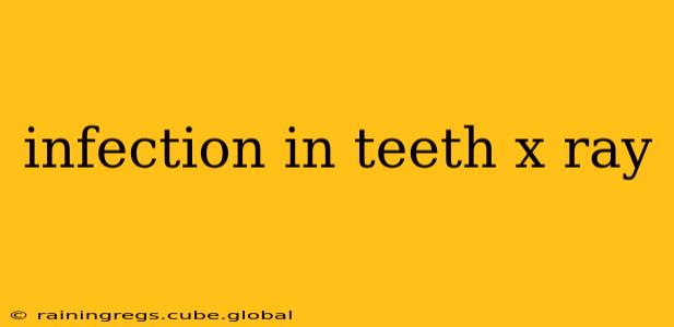 infection in teeth x ray