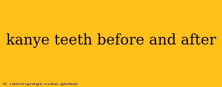 kanye teeth before and after