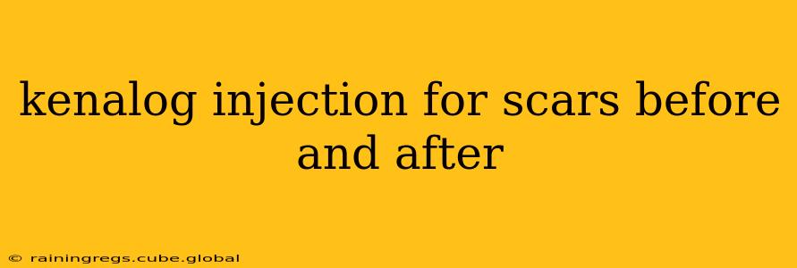 kenalog injection for scars before and after