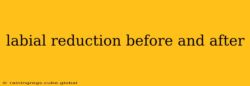 labial reduction before and after