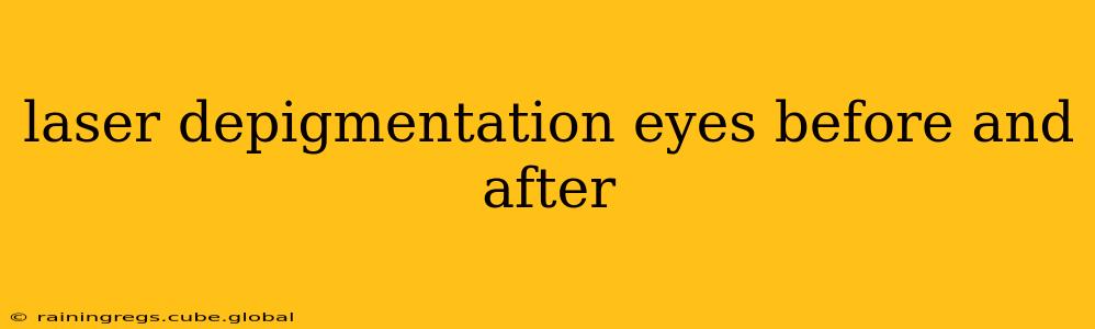 laser depigmentation eyes before and after