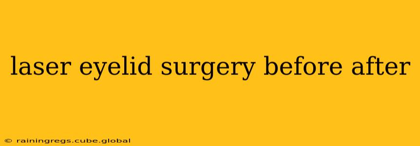 laser eyelid surgery before after