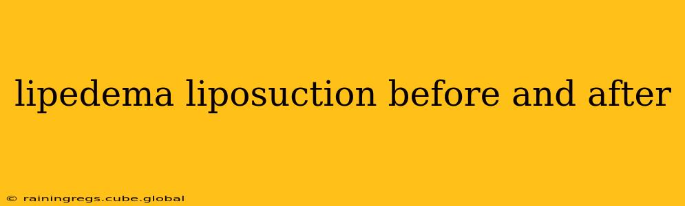 lipedema liposuction before and after