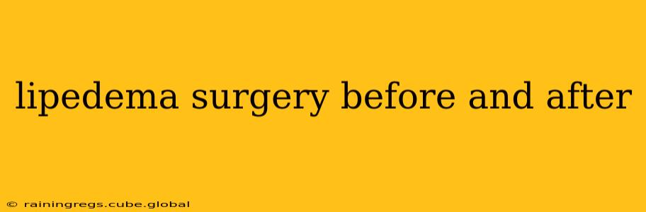 lipedema surgery before and after