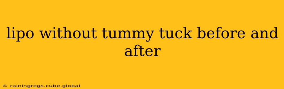 lipo without tummy tuck before and after