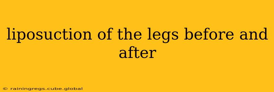 liposuction of the legs before and after