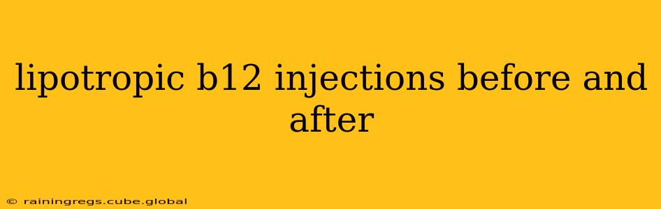 lipotropic b12 injections before and after