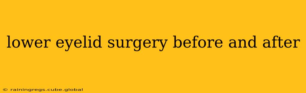 lower eyelid surgery before and after