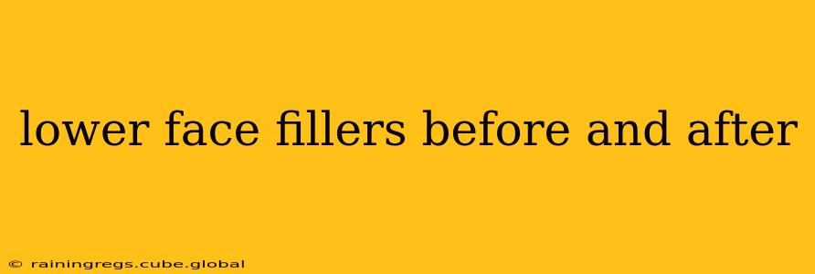 lower face fillers before and after