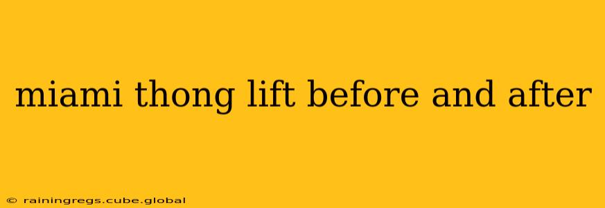 miami thong lift before and after