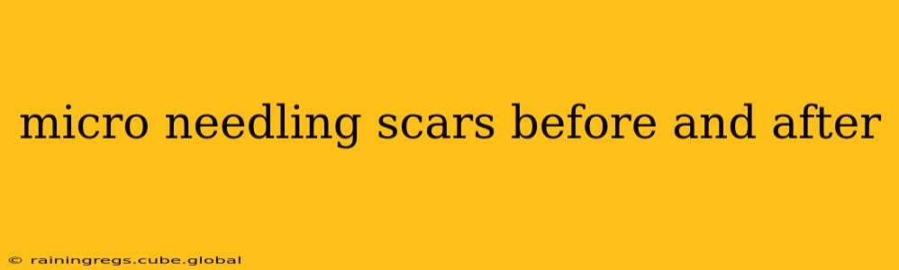 micro needling scars before and after