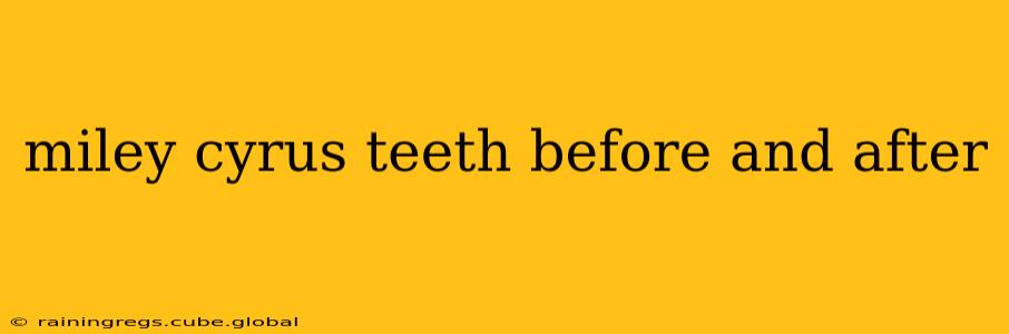 miley cyrus teeth before and after