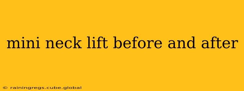 mini neck lift before and after