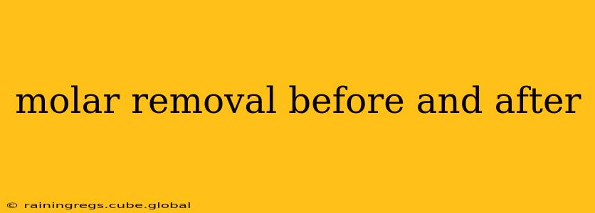 molar removal before and after