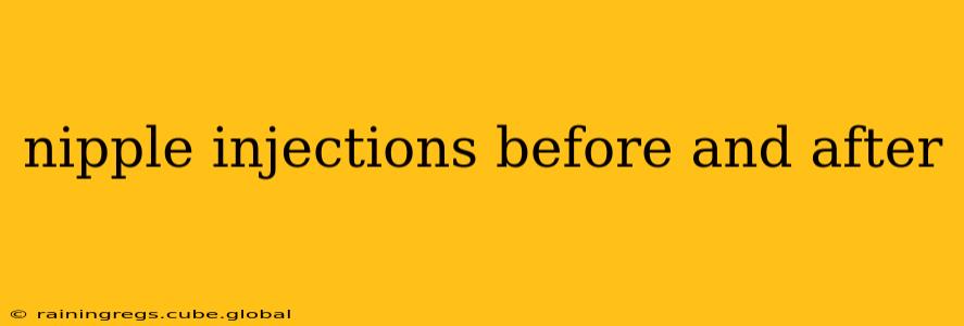 nipple injections before and after