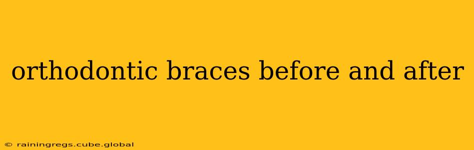 orthodontic braces before and after