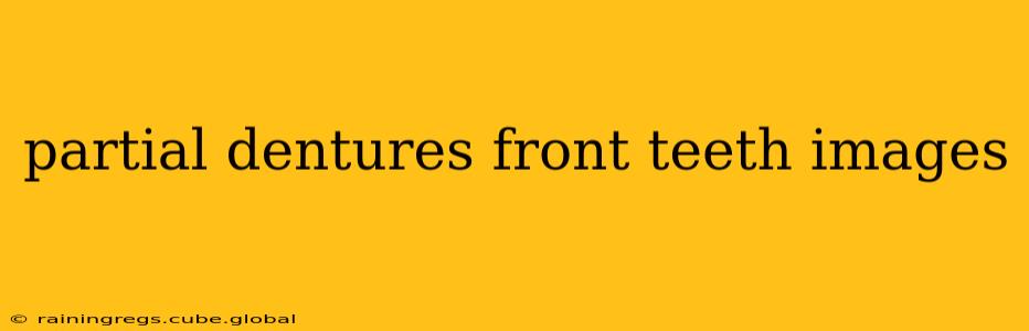partial dentures front teeth images