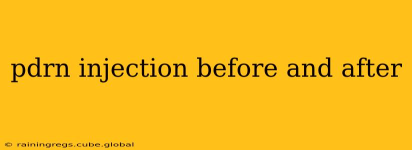 pdrn injection before and after