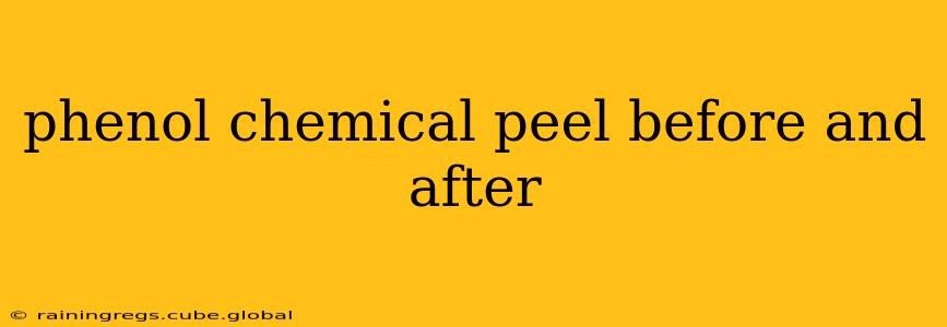 phenol chemical peel before and after