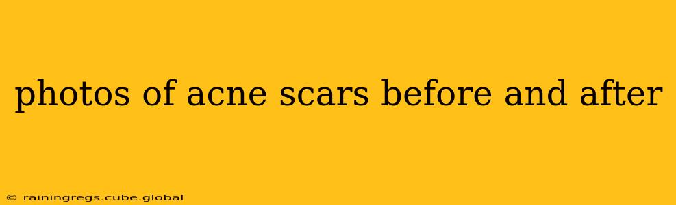 photos of acne scars before and after