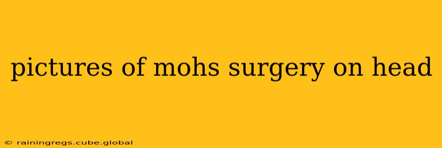 pictures of mohs surgery on head