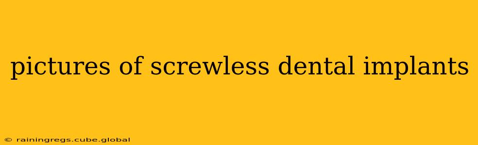 pictures of screwless dental implants