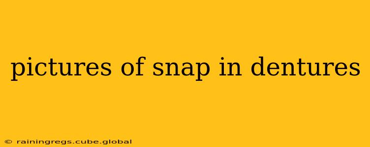 pictures of snap in dentures