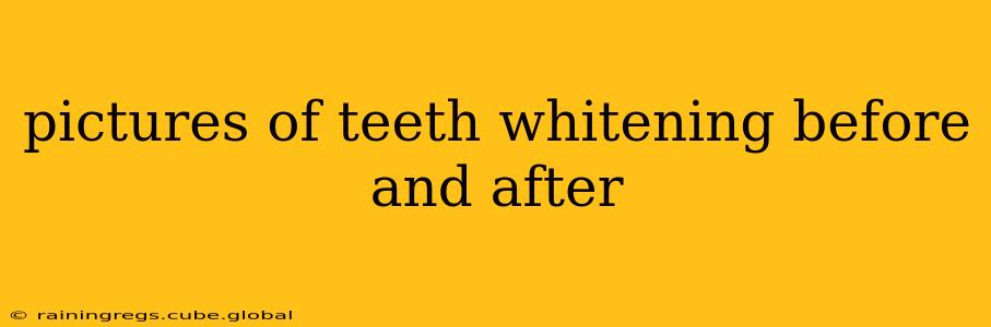 pictures of teeth whitening before and after