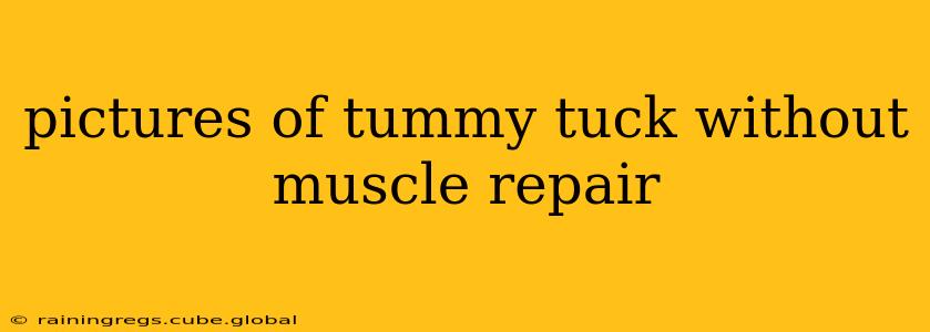 pictures of tummy tuck without muscle repair