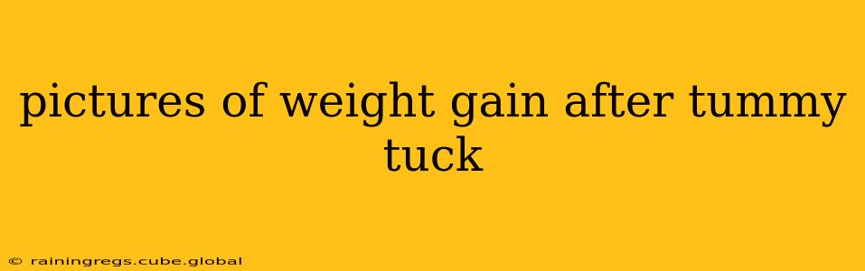 pictures of weight gain after tummy tuck