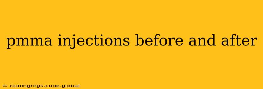 pmma injections before and after
