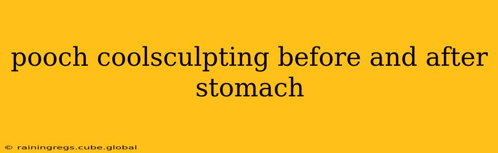 pooch coolsculpting before and after stomach
