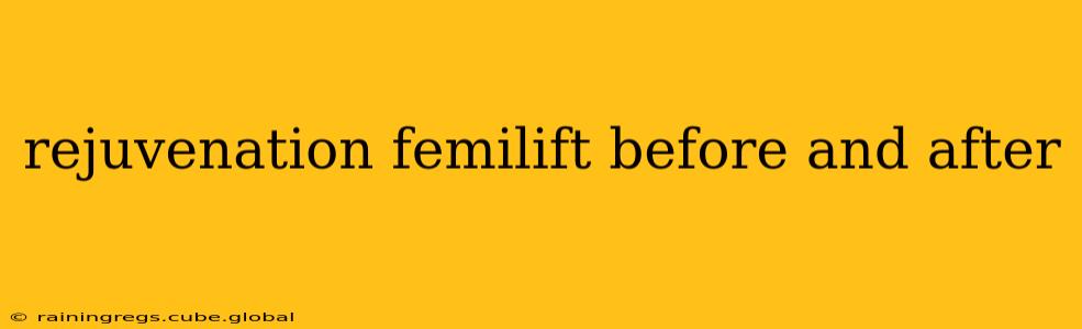 rejuvenation femilift before and after