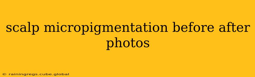 scalp micropigmentation before after photos