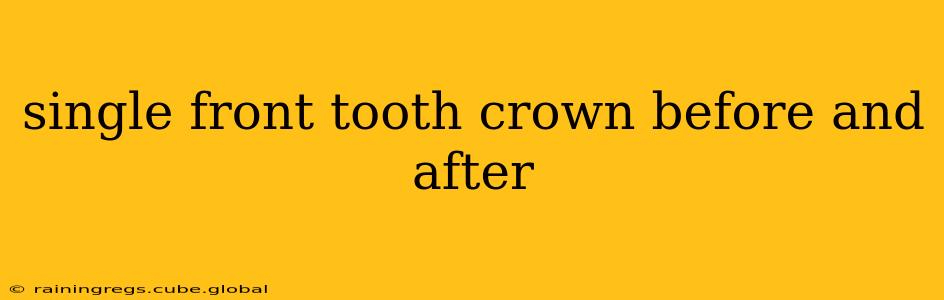 single front tooth crown before and after