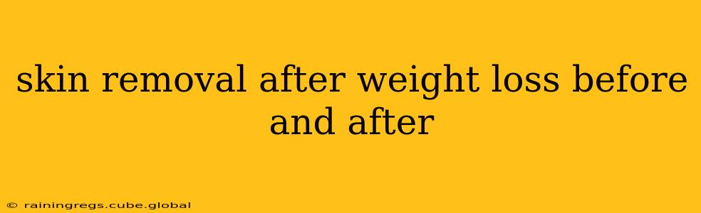 skin removal after weight loss before and after