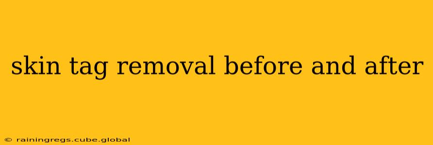 skin tag removal before and after