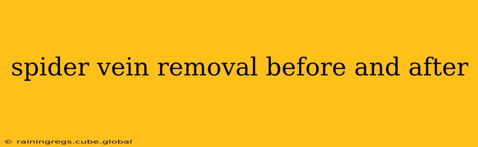 spider vein removal before and after