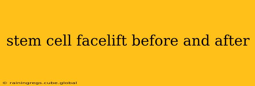 stem cell facelift before and after