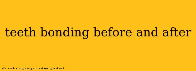 teeth bonding before and after