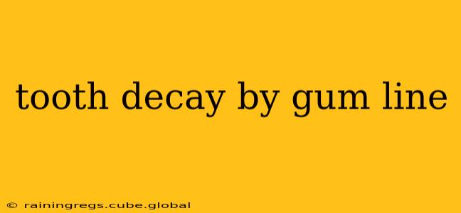 tooth decay by gum line