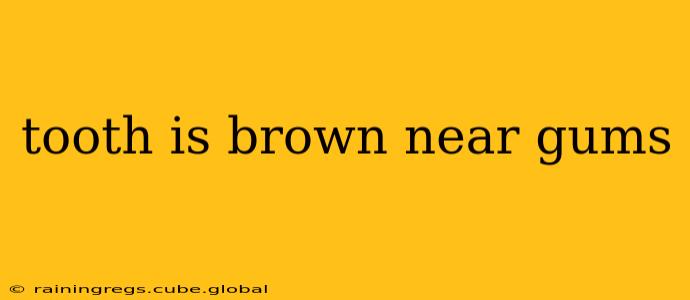tooth is brown near gums