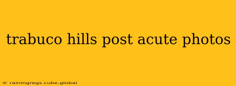 trabuco hills post acute photos